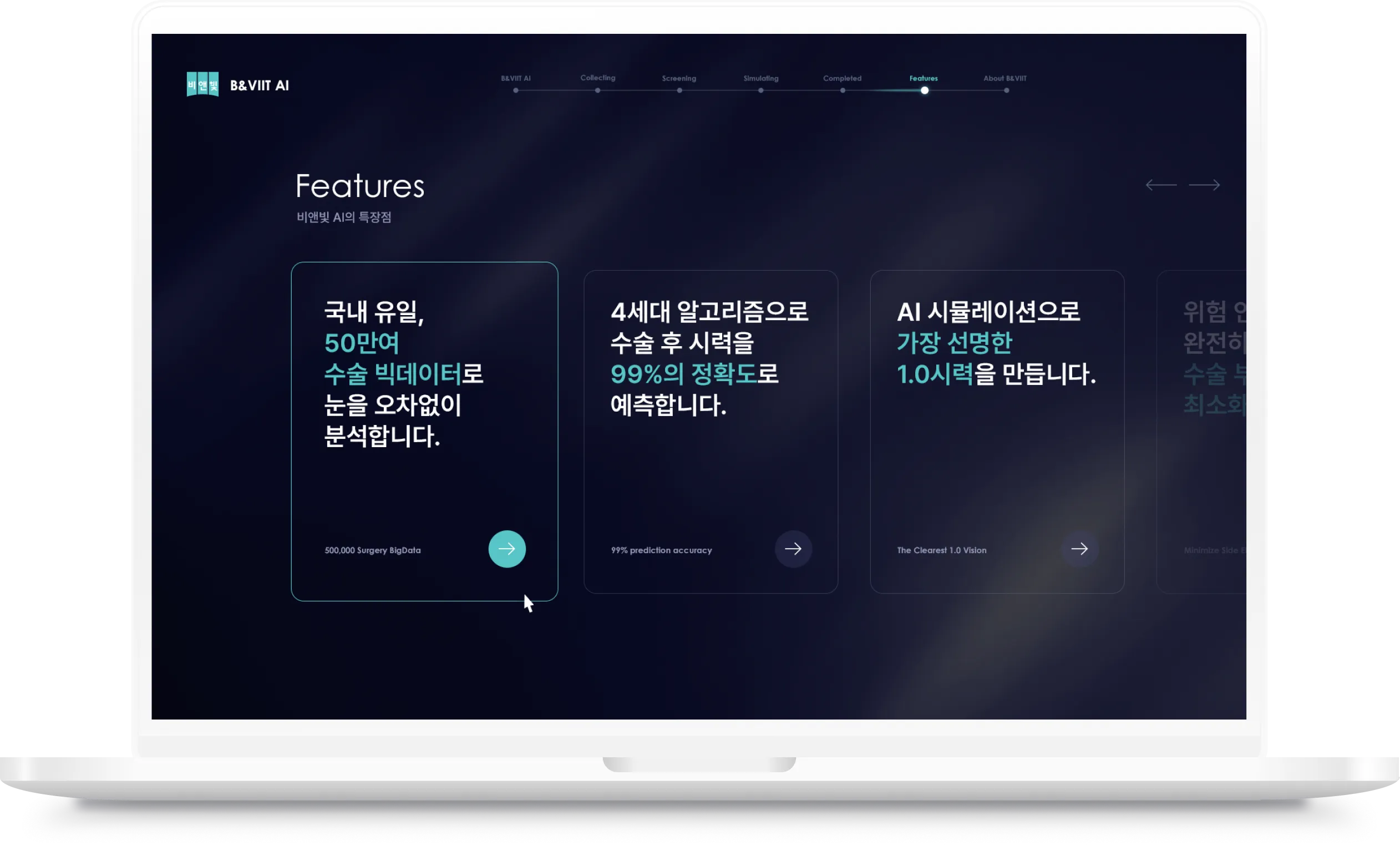 비앤빛 안과 AI 특장점 화면